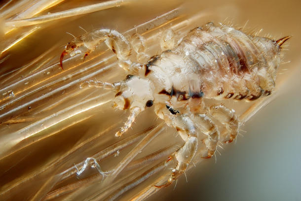 Head Lice? Selfies Might Be to Blame!