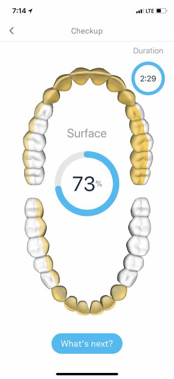 The Kolibree Ara Toothbrush Is a Fun Way of Keeping the Dentist Away 6 The Kolibree Ara Toothbrush Is a Fun Way of Keeping the Dentist Away