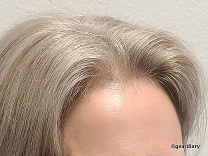 Close-up of the author's hairline on June 24, 2021