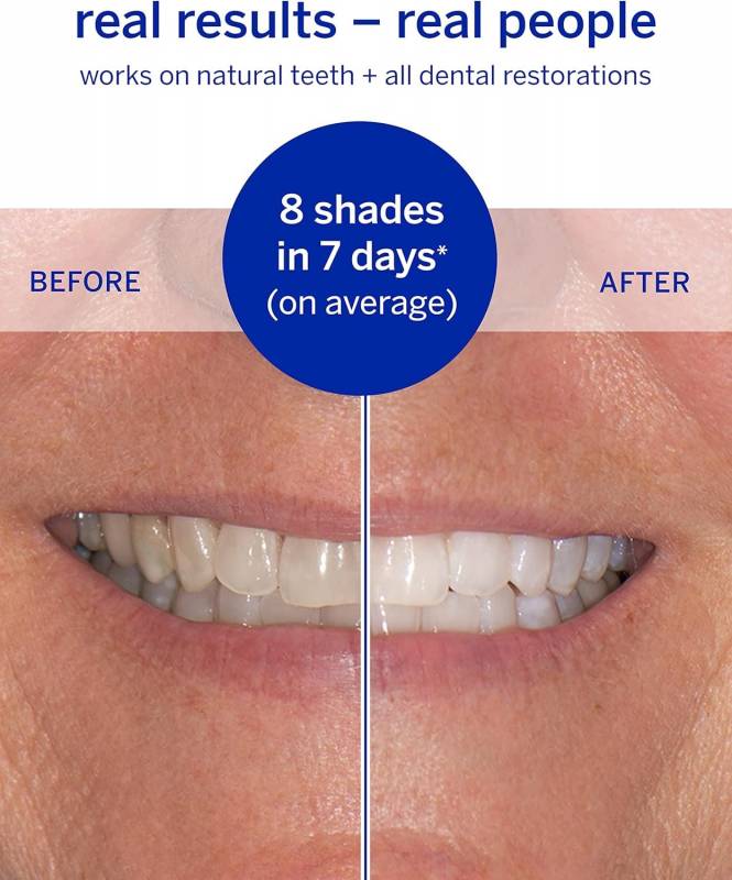 Supersmile Professional Dissolving Superstrips