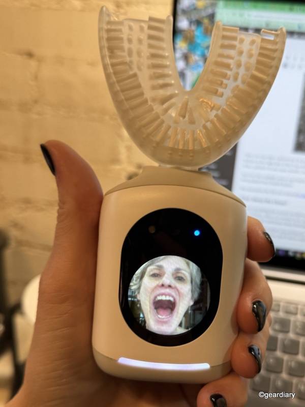 The author's mouth scan shown on the Feno Smartbrush display 