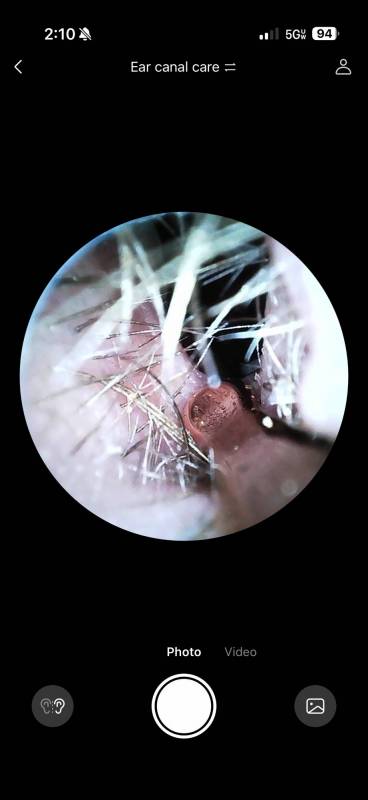 Bebird EarSight Ultra X Review: A 4K Smart Ear Cleaner That Lets You See (and Safely Remove) the Gross Stuff 3 Looking at the author's ear canal with the Bebird EarSight Ultra X