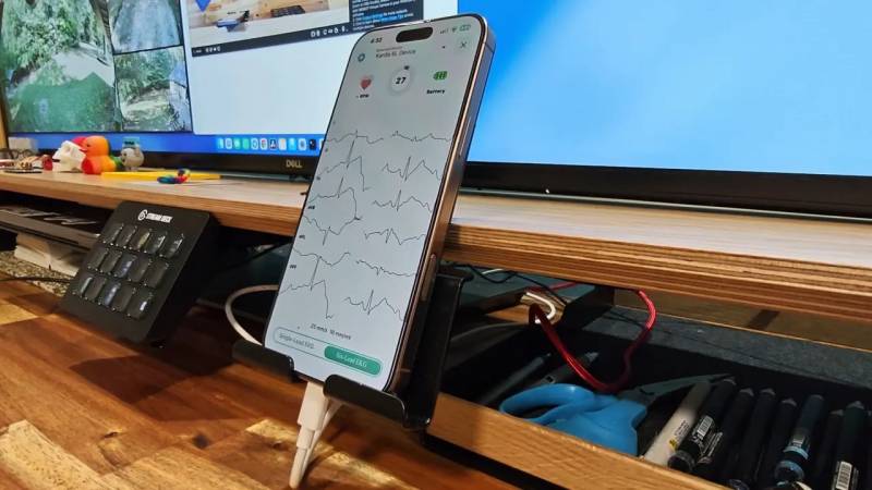 AliveCor KardiaMobile 6L Review: An EKG Device in Your Pocket 10 KardiaMobile 6L 6-lead test