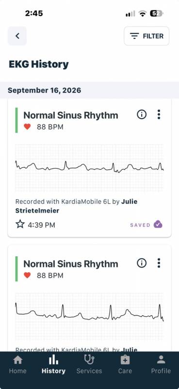 AliveCor KardiaMobile 6L Review: An EKG Device in Your Pocket 7 KardiaMobile 6L app screenshot